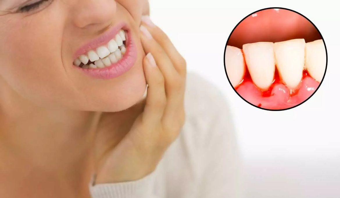 Home Remedies to Improve Your Oral Health